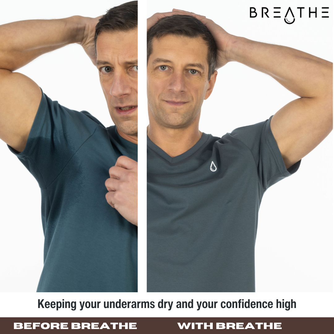 The Effects of Hyperhidrosis on Mental Health